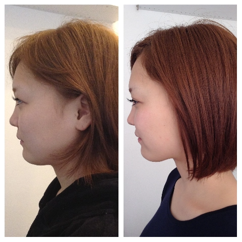 小顔矯正や小尻 ブライダルやプロポーション矯正は当サロンにお任せください お店直送 情報お届け便ニュース 美容矯正サロン Re Birth 整体 富士市 静岡ナビっち